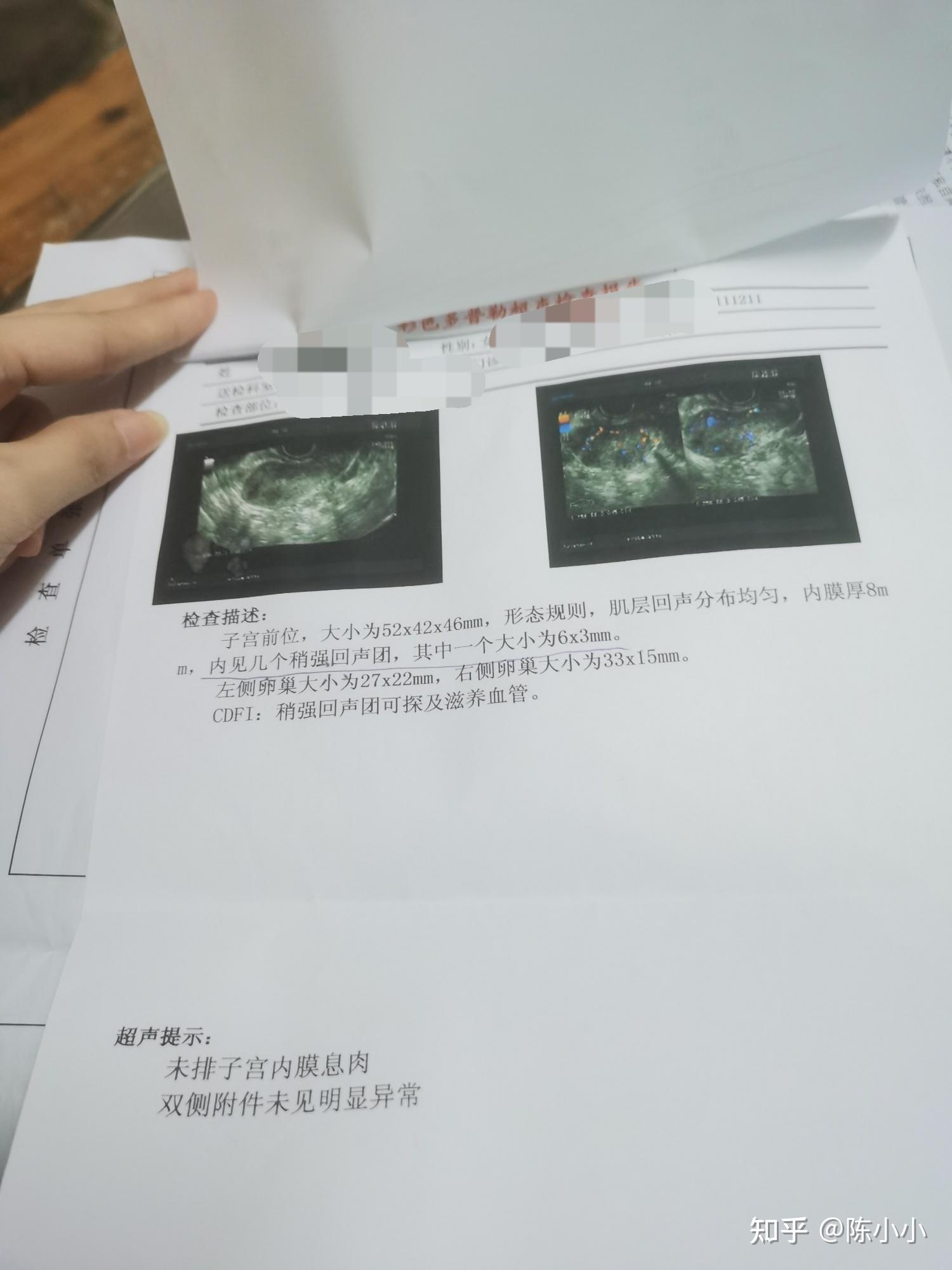 子宫内膜厚,回声不均匀,做了宫腔镜是种什么体验