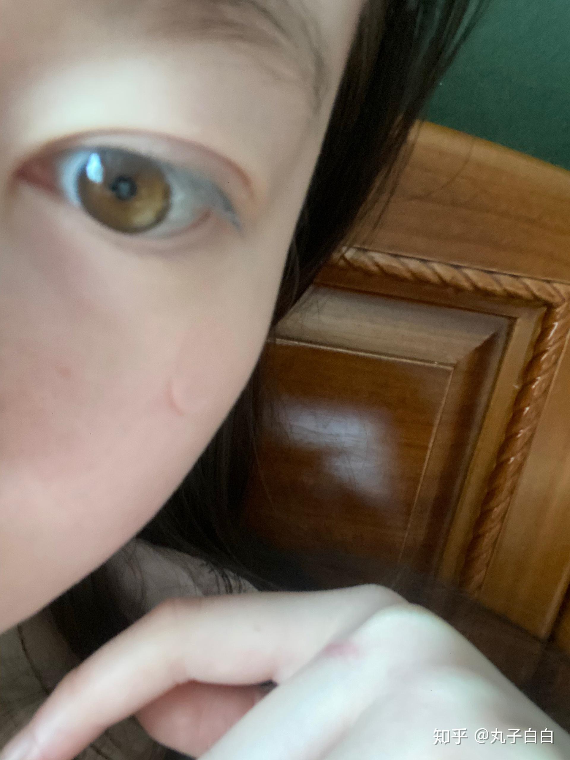 为什么有的中国人的眼珠是黄棕色的.