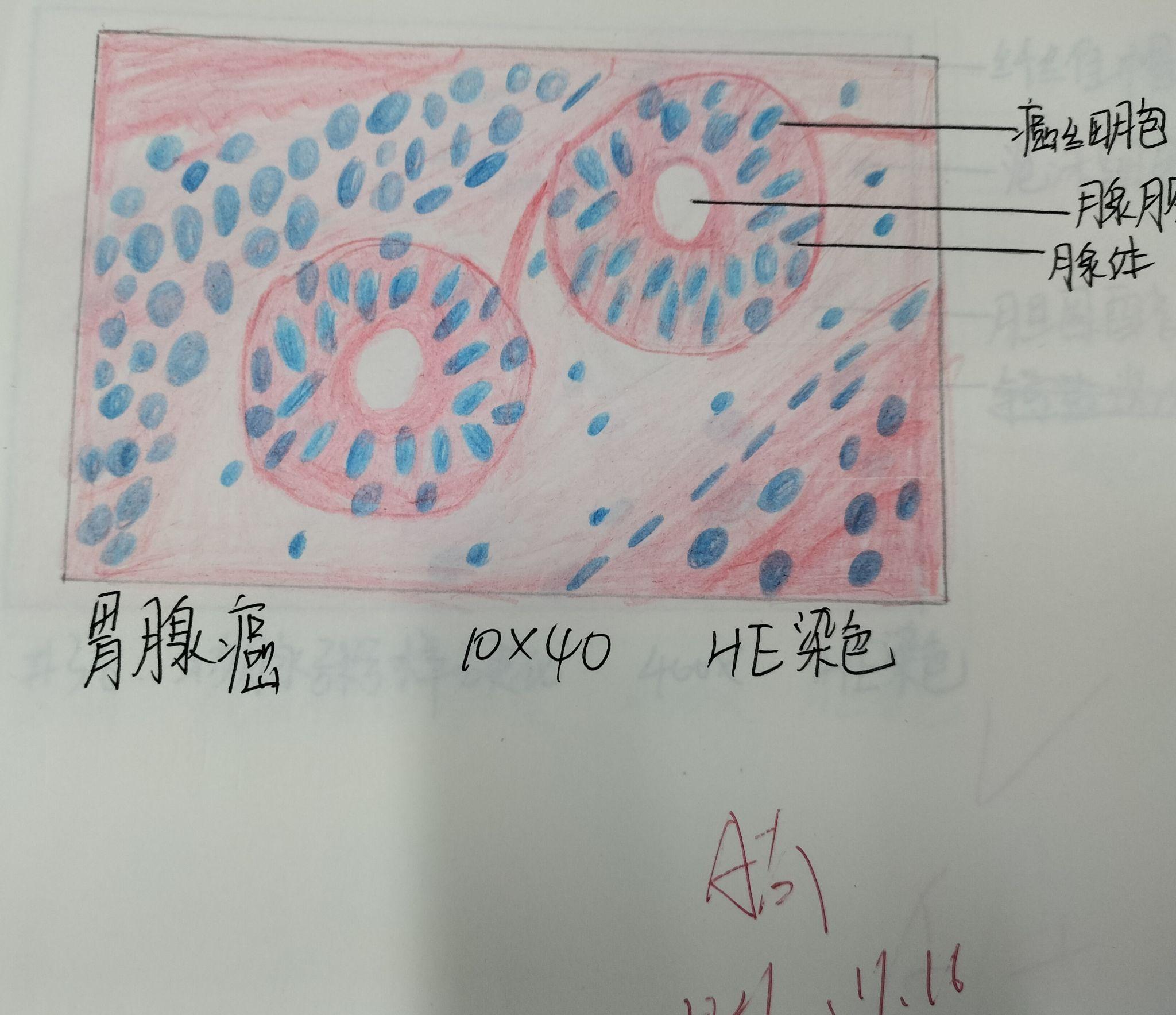 病理学红蓝铅笔绘图