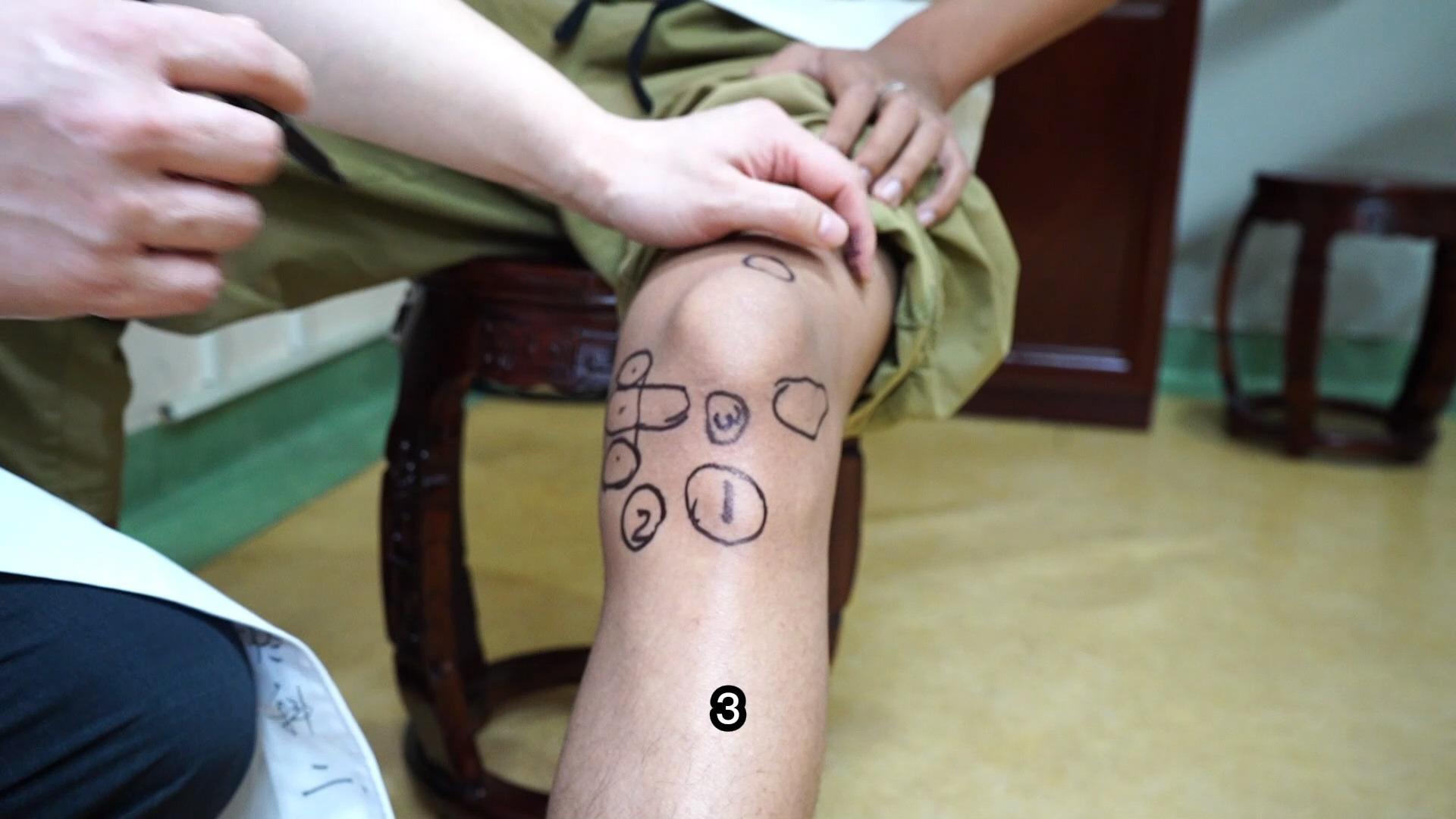 2022-07-05 09:24 · 2 万次播放膝盖膝盖损伤疼痛骨科健康半月板写下