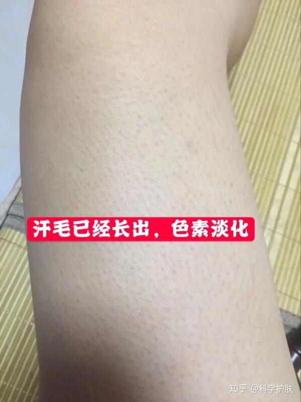 这个是鸡皮肤吗(这个是鸡皮肤吗英语)