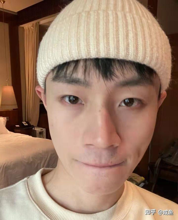 哪款眼霜男士用去除黑眼圈效果好? - 知乎