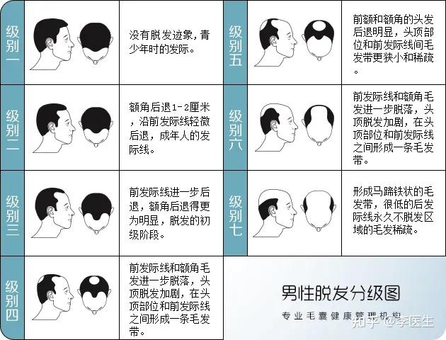 植发医院排名_深圳植发医院一般多少钱新生植发_植发医院选择攻略