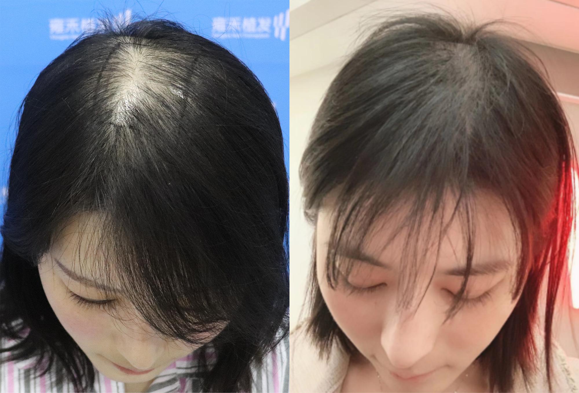 如何使发量变多? - 知乎