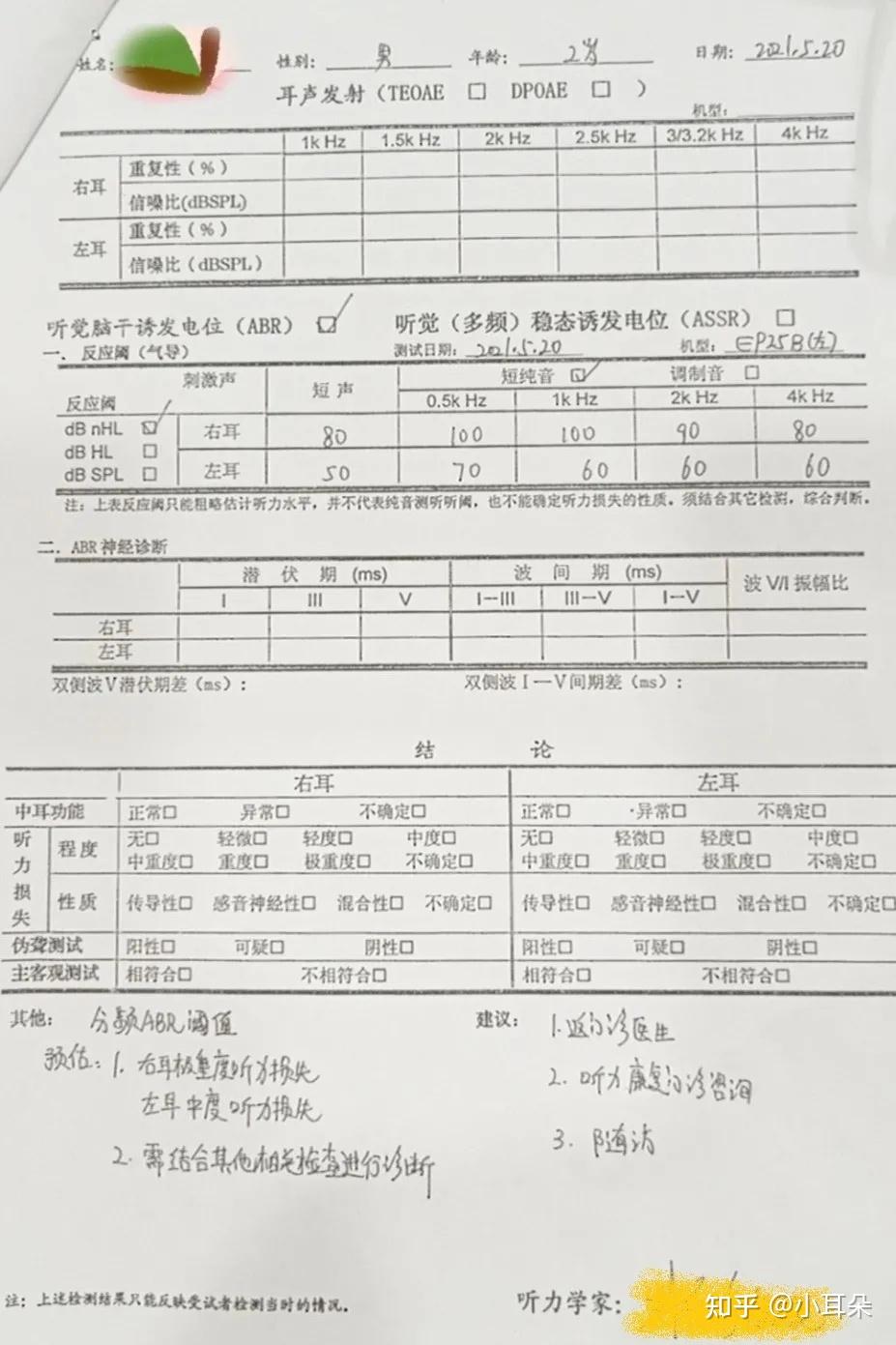 合川惠耳助听器与你分享聋哑父母的宝宝一定会耳聋吗