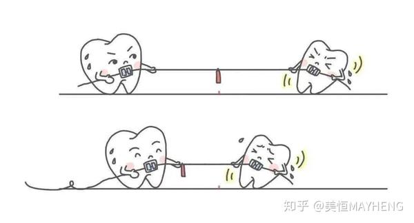 很多人去做牙齿矫正之前都听过这句,"牙齿矫正一怕拔牙,二怕打骨钉