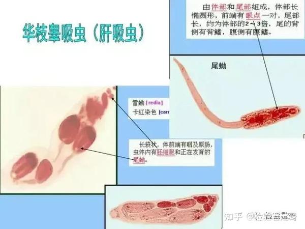 【检验图谱】寄生虫汇总,多图慎入! - 知乎