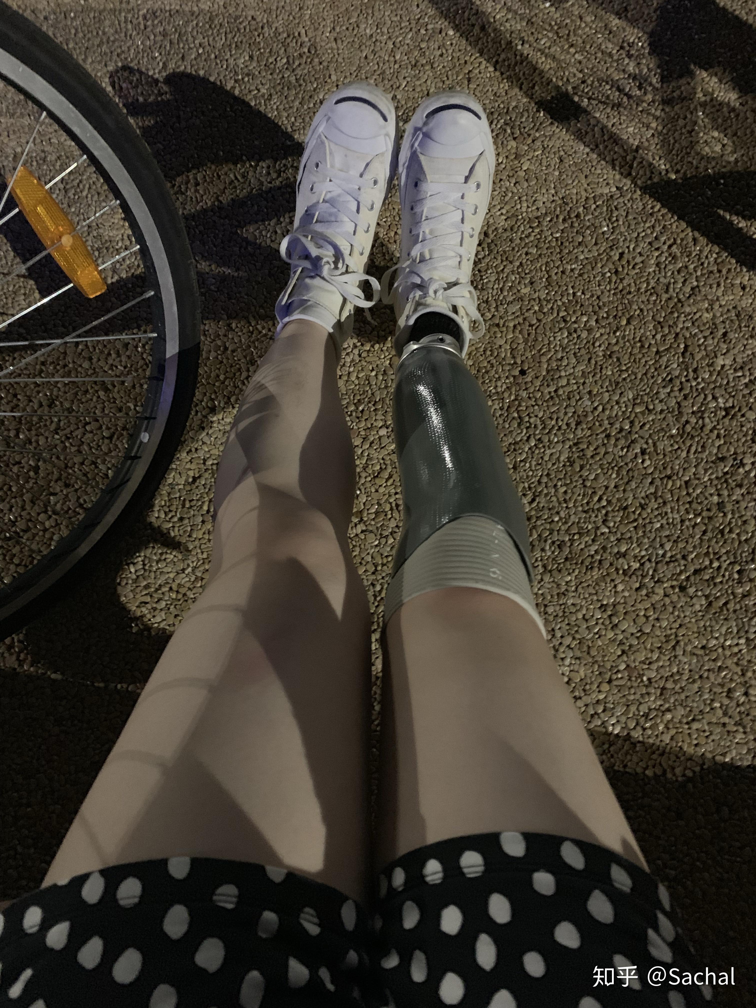 在街上遇到露出假肢的残疾人,你怎么看? - 知乎