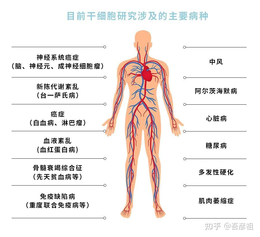 新生儿干细胞储存到底有没有用？ 知乎 2177