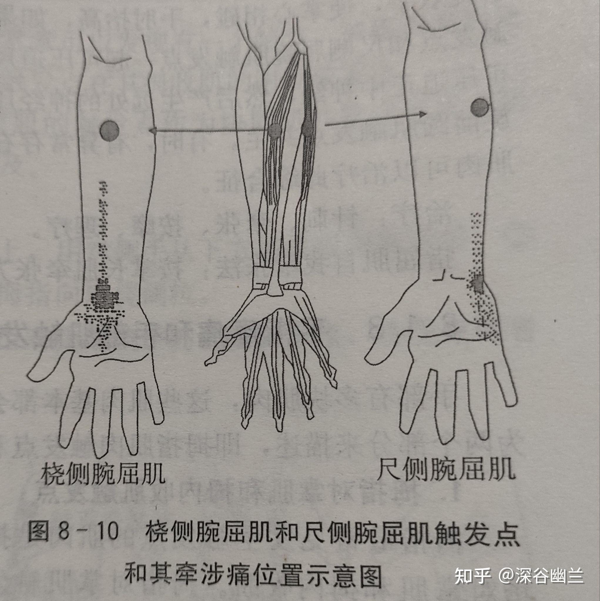 透过解剖经渠穴处查病因 - 知乎