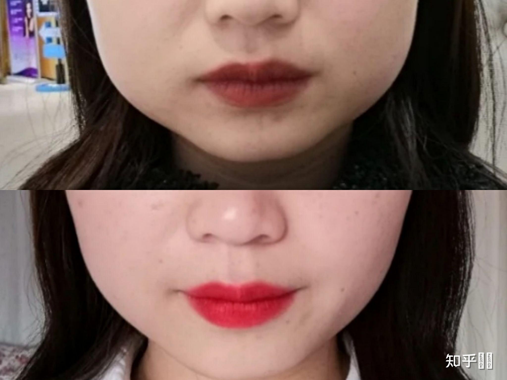 咬肌可以通过精油瘦下来吗