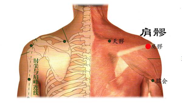 艾灸治肩周炎灸位图图片