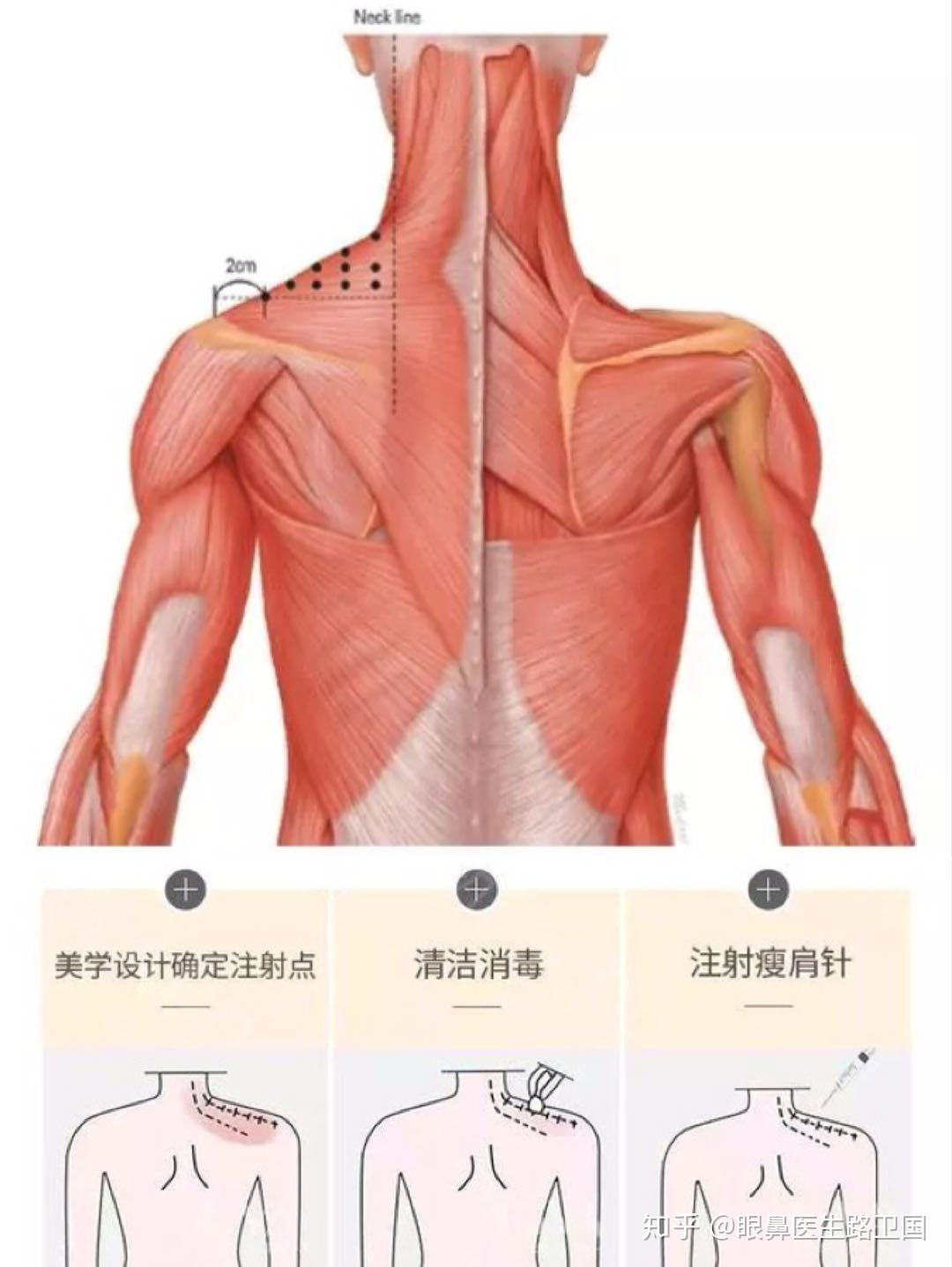 正常人的肩部示意图图片