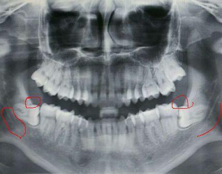 v2-4d7889ecbf866cedc6d2eeaadece4b44_r.jpg