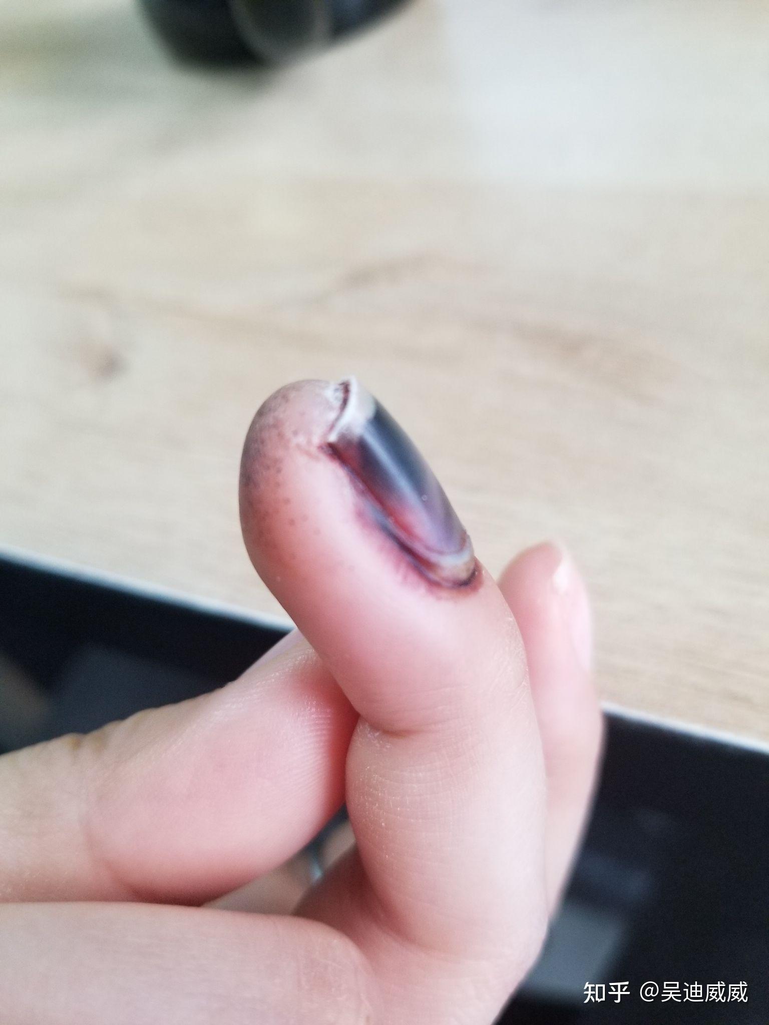 被门夹到手是一种什么体验? - 知乎