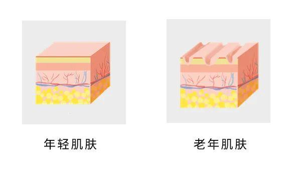 人未老脸先衰?了解皮肤衰老的元凶——光老化 - 知乎