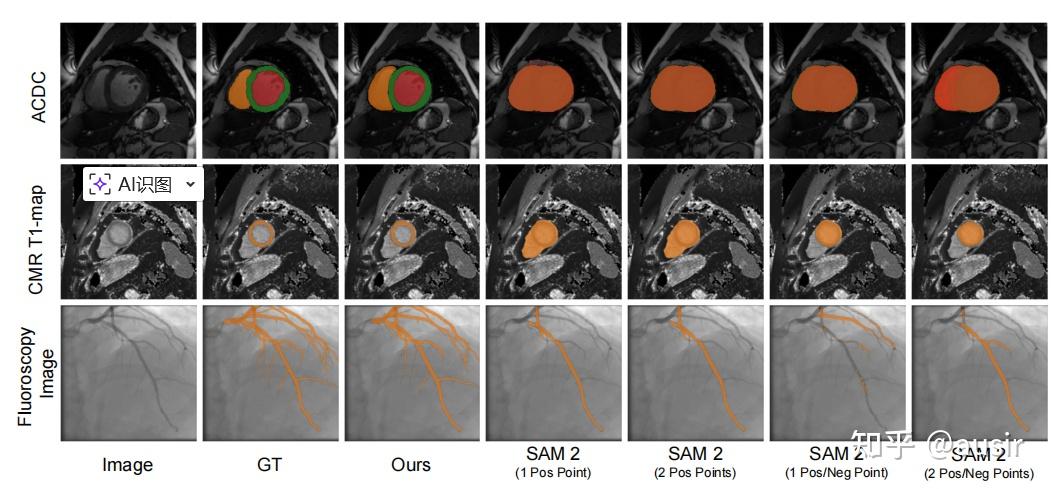 Retrieval-Augmented Few-Shot Medical Image Segmentation With Foundation ...