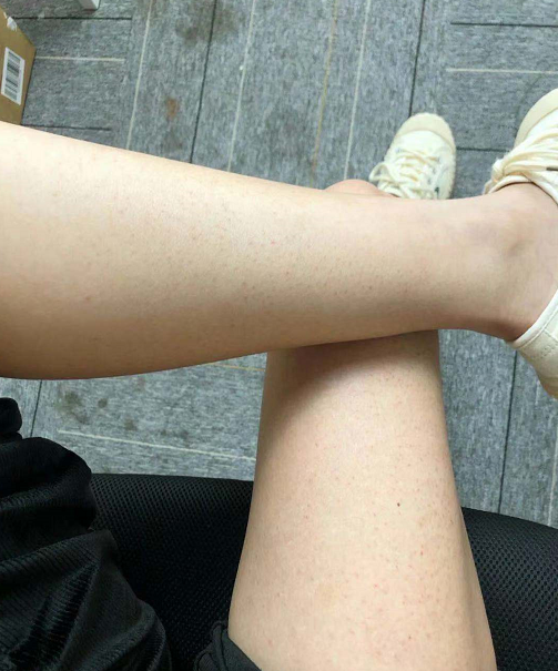 鸡皮肤不敢恋爱知乎的简单介绍
