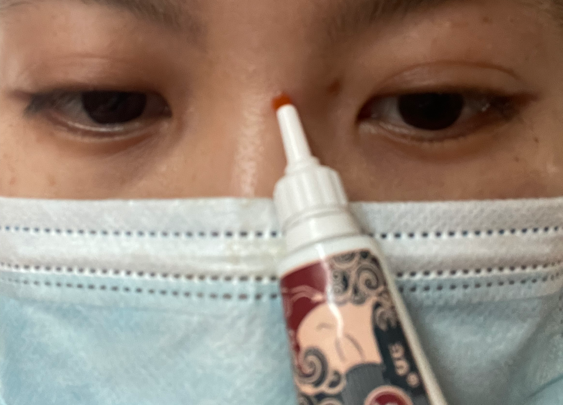 立方克痤隐酮凝胶的体验心得