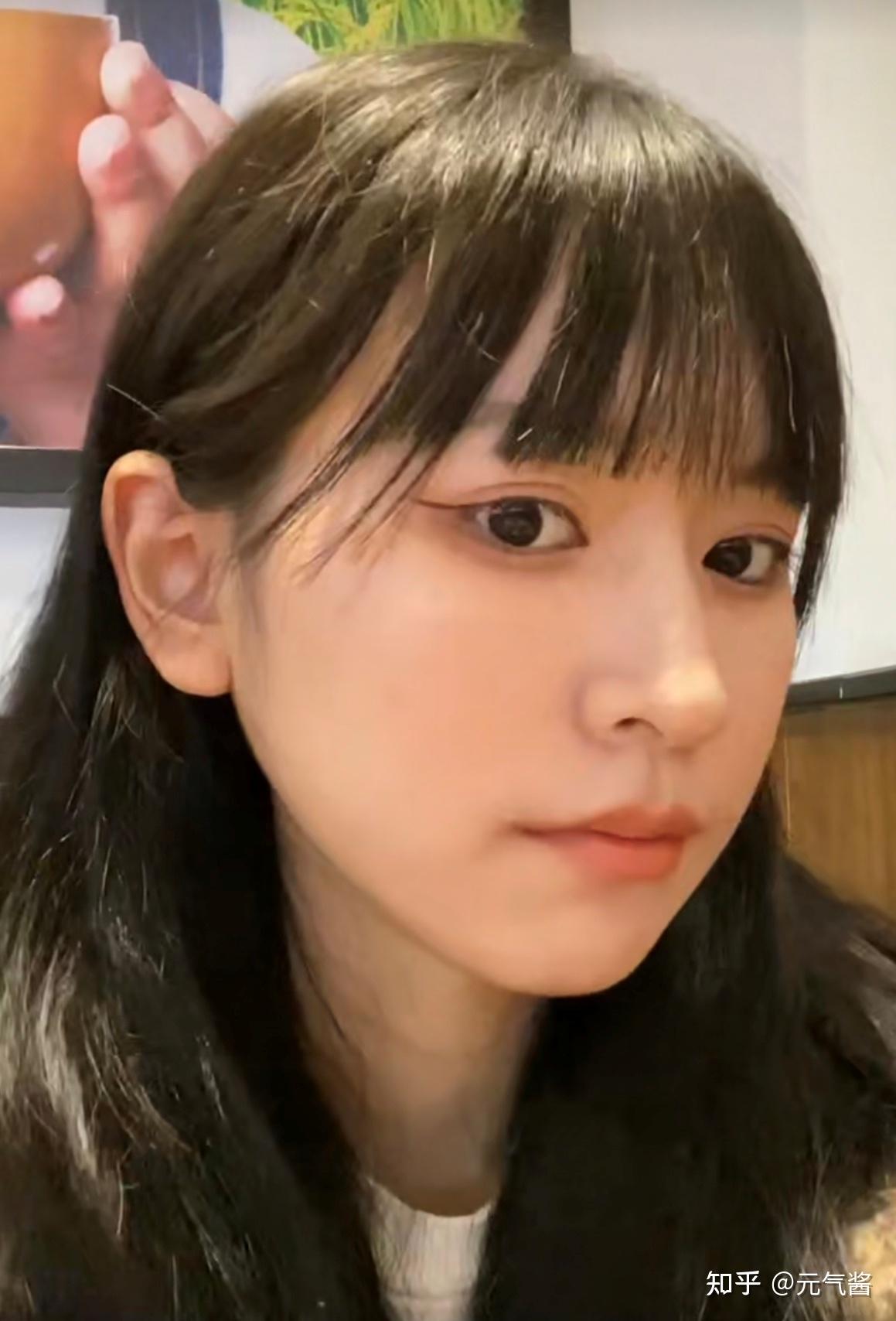 为了过心理那关容貌焦虑女孩还是去上海做了下颌角磨骨心得分享