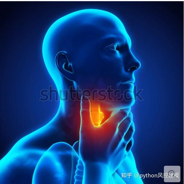 一图读懂慢性咽喉炎Chronic pharyngitis - 知乎