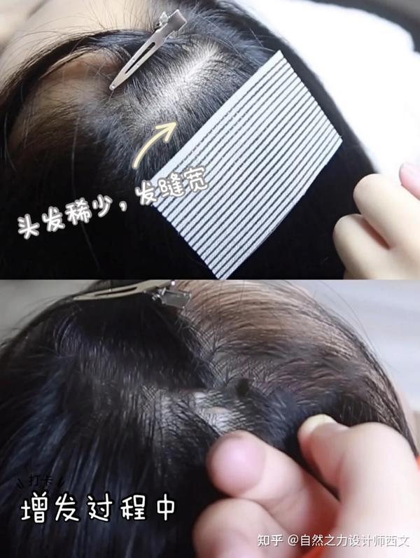 不可不知的养发护发小常识 - 知乎