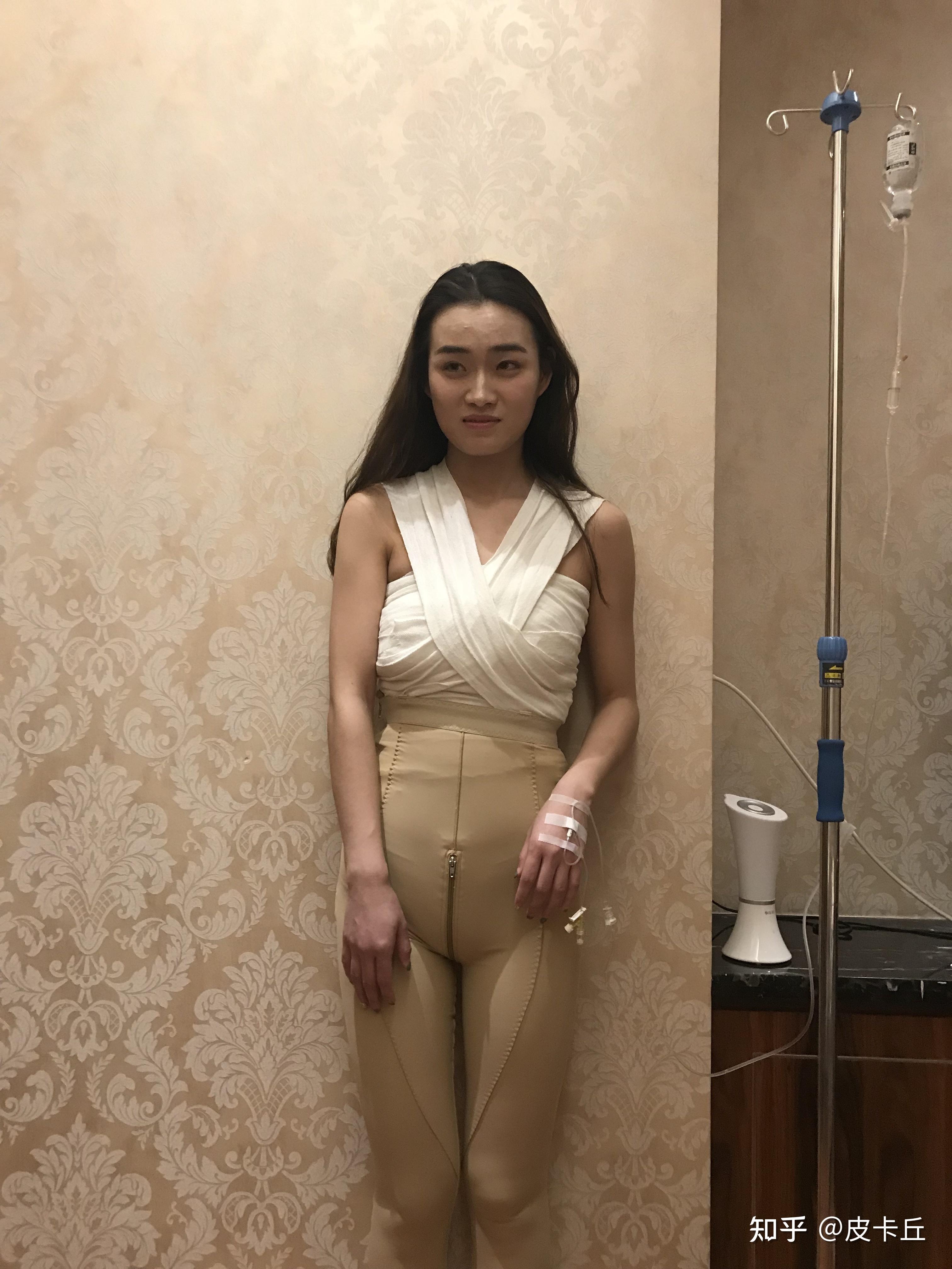 【李朕】大三姑娘来做自体脂肪丰胸,术后3天,成功升杯_丰胸10大_美食图片