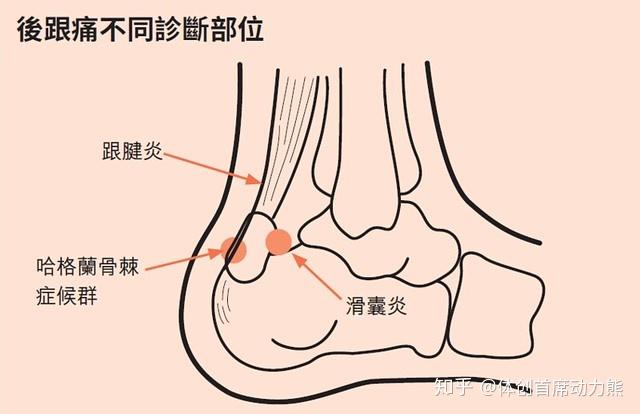 脚腕位置图片图片