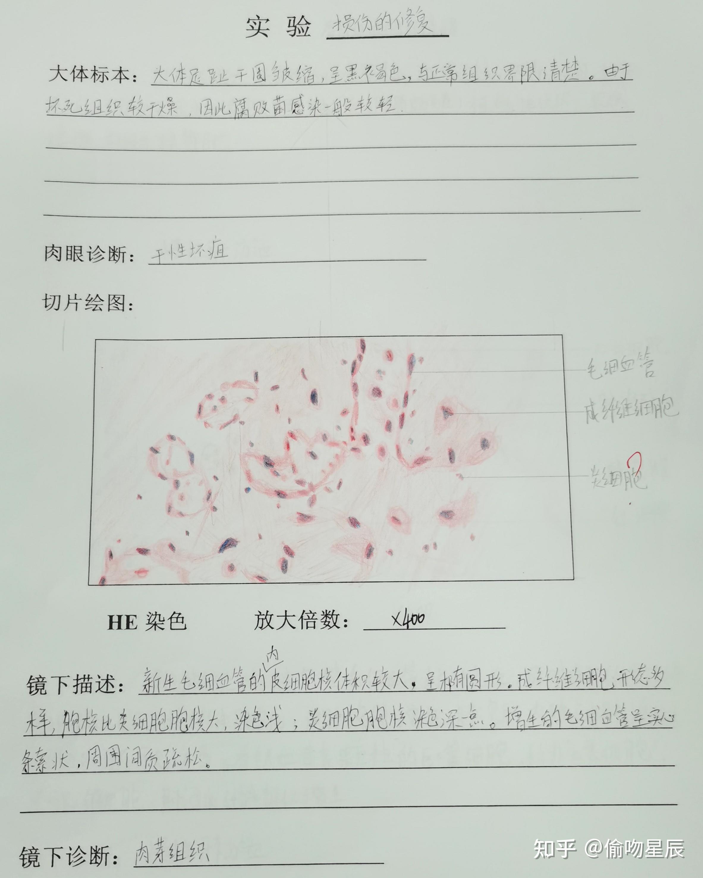 肠腺瘤红蓝铅笔手绘图图片