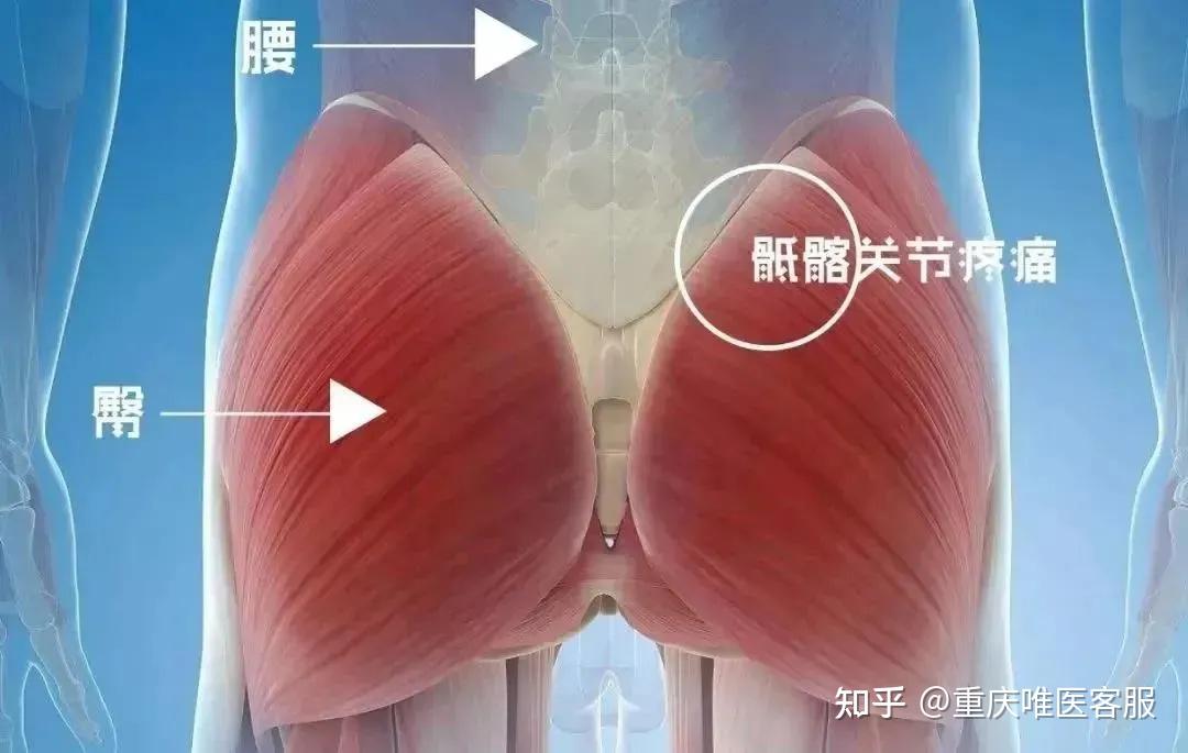 女性腰骶部酸痛位置图片