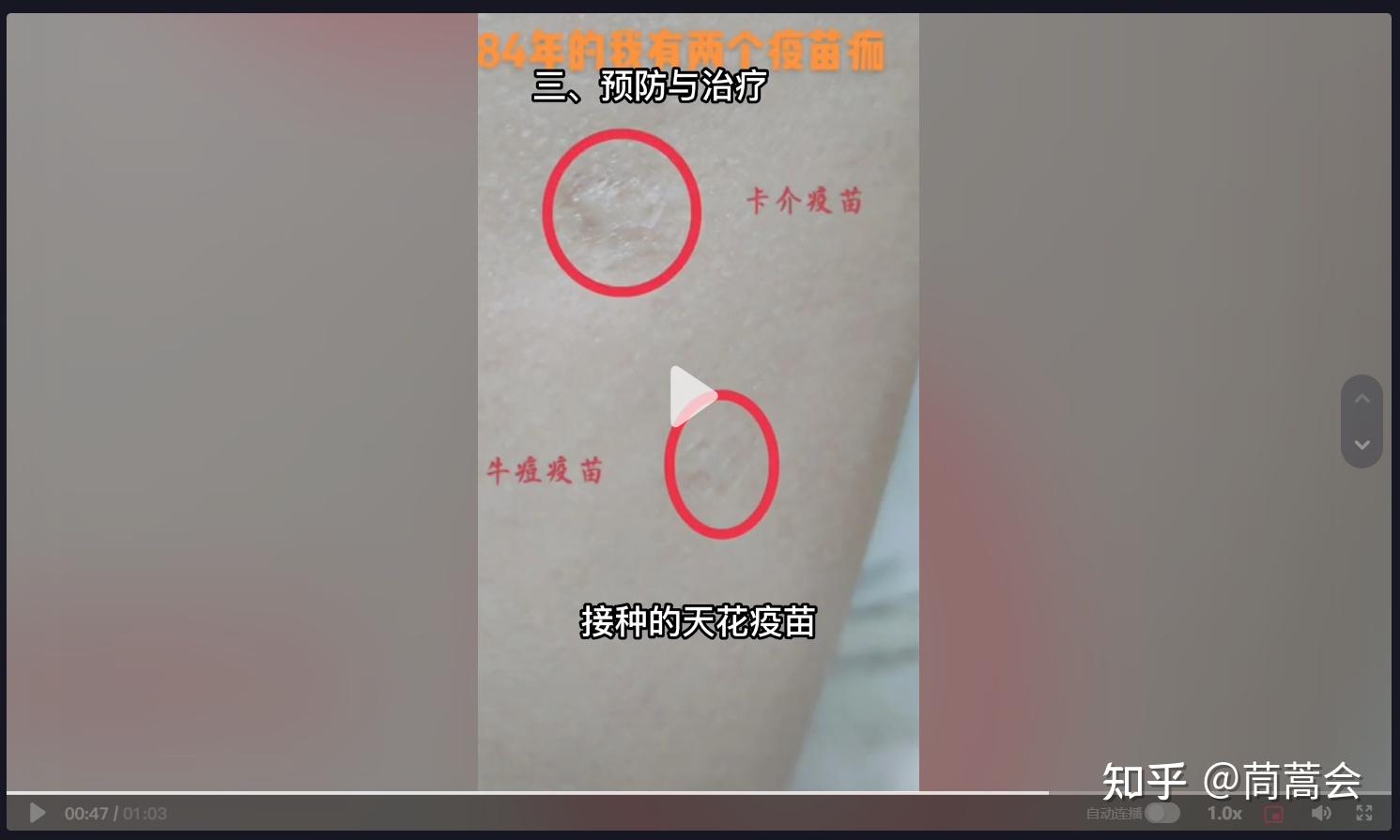 网络热门猴痘科普鉴定你的哪个疫苗疤防得住它