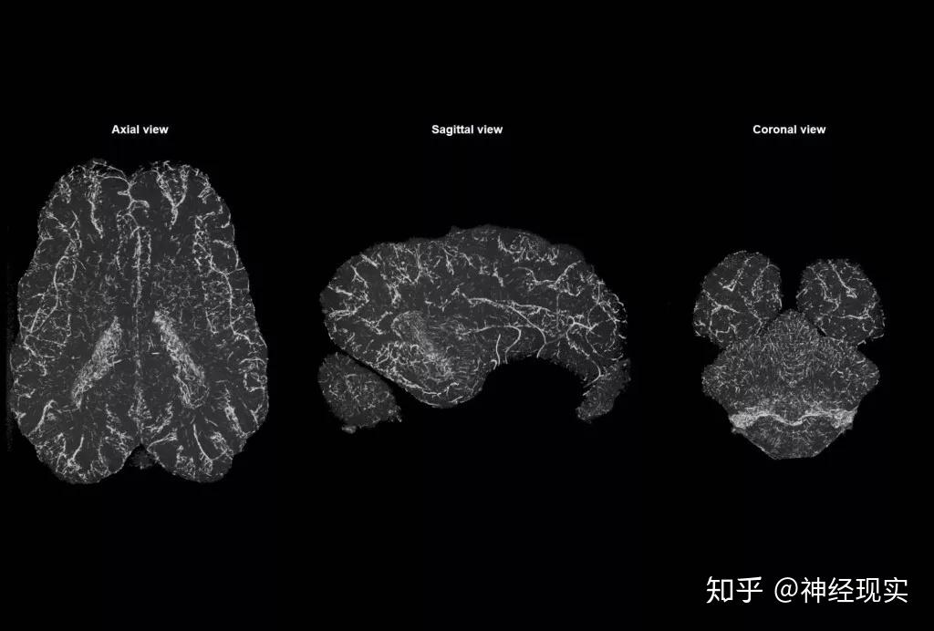 离缸中之脑还远但离我们的生活很近八位专家评复活死亡大脑