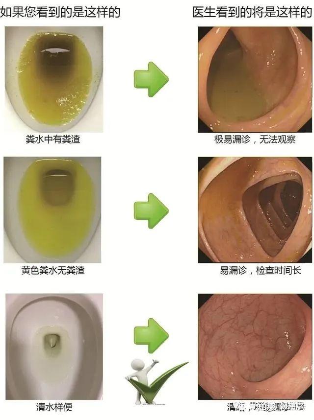 清洁剂一个小时左右开始排便