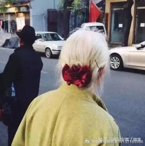 多少岁开始长白发正常 v2-4f36825ae36ebb16298358e02be73690_r.jpg