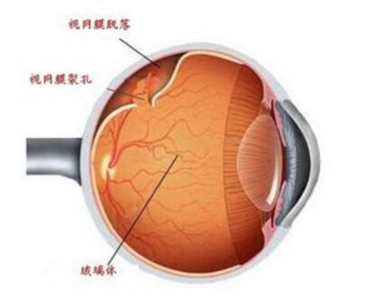 黑暗时眼睛出现闪光感是怎么回事? - 知乎