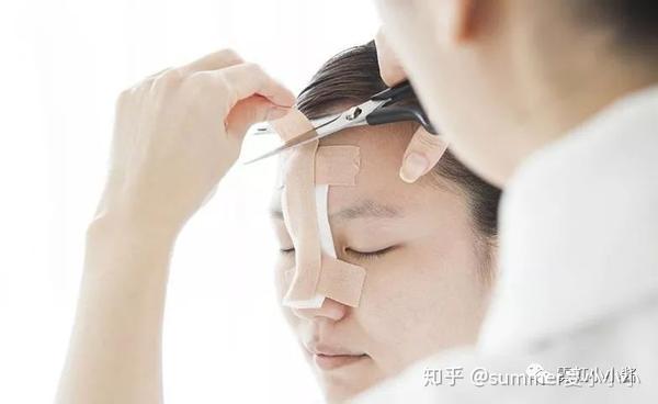 整形失败了怎么办 如何避免越来越糟的情况出现 日本医美 知乎