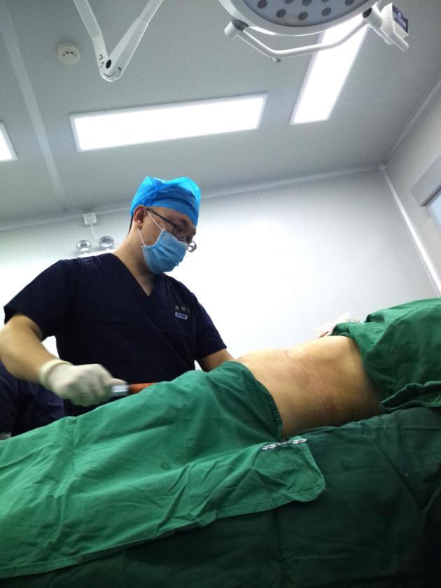 抽脂到底痛不痛