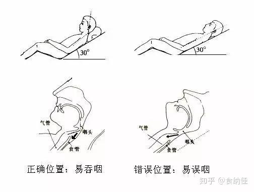 体位及姿势 最好定时,定量,能坐起来不要躺着,能在餐桌上不要在床边
