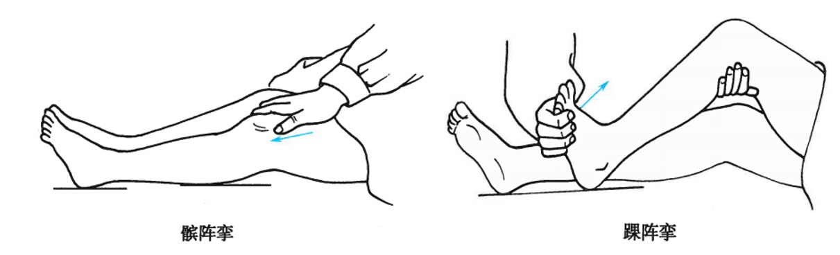 此外,髌阵挛也经常要查体:我们的操作手法是,让患者仰卧,并且此时