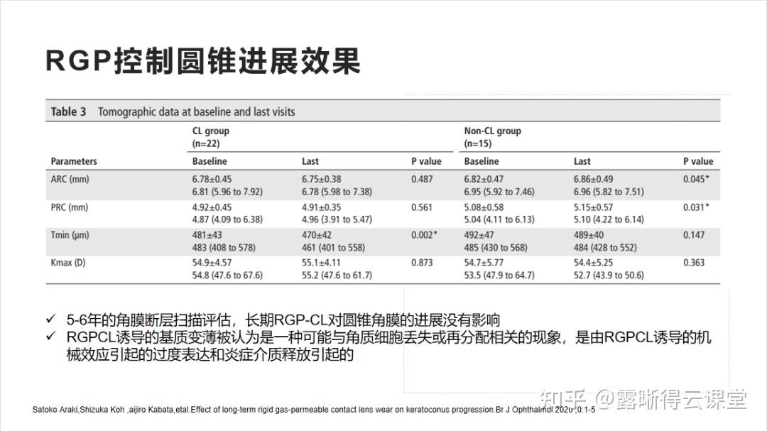 圆锥角膜的RGP验配及RGP临床效果分析（文字版） - 知乎