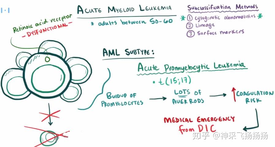医学科普之急性白血病acuteleukemia