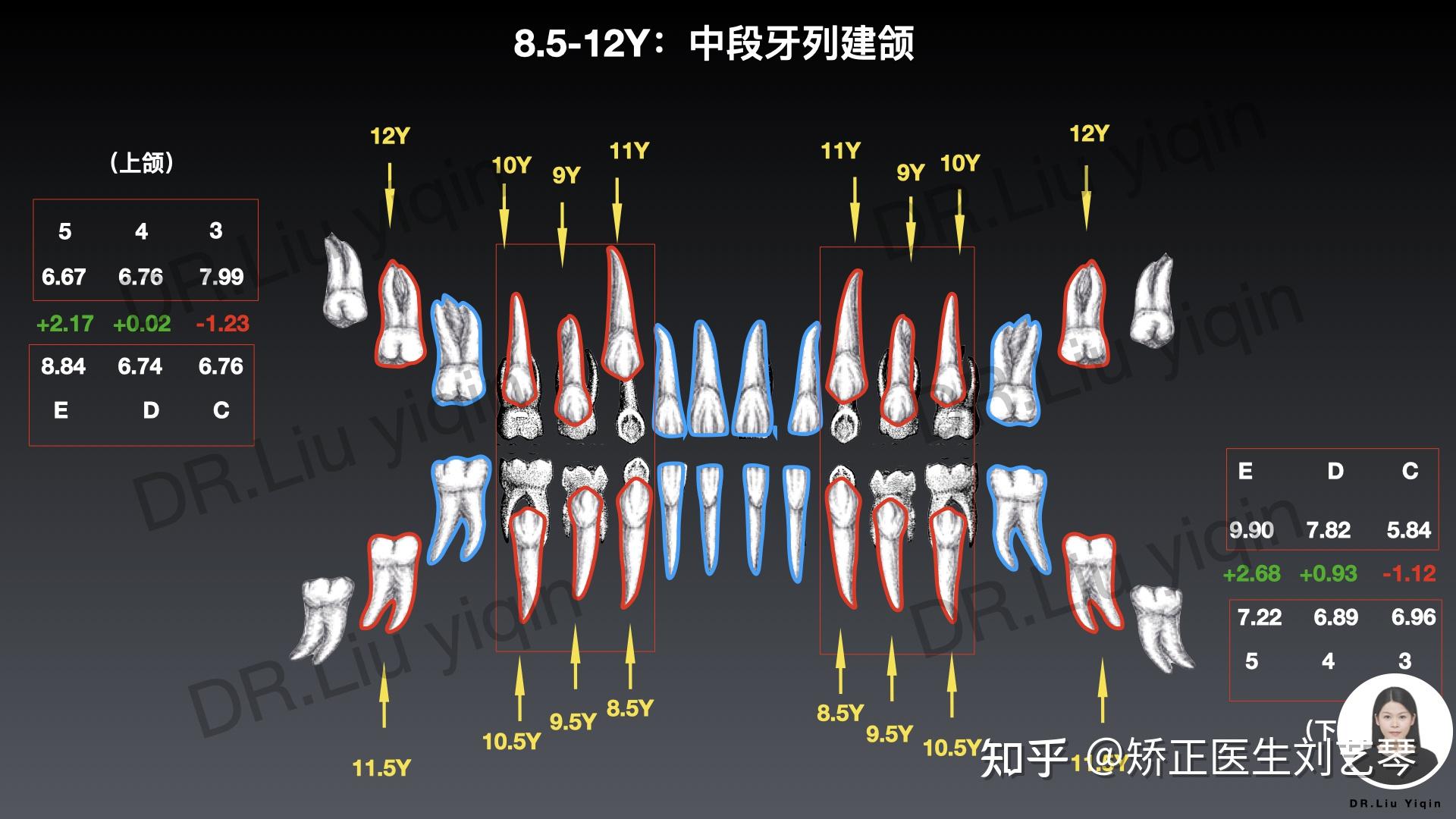 人一般有多少颗牙齿? - 知乎