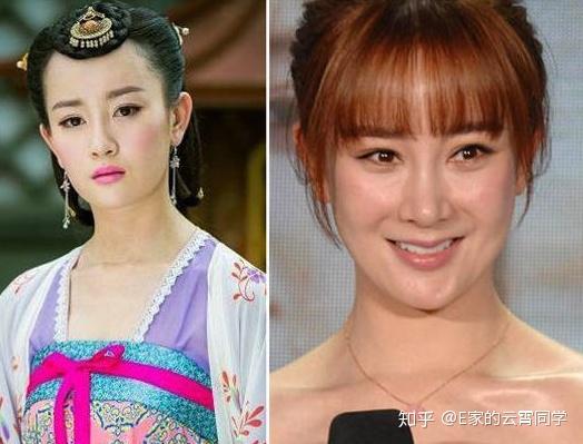 张檬整容后遗症来了?与2个月前照片相比,整个人都"脱相"了