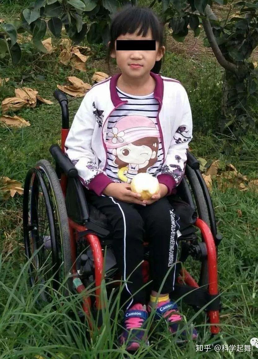 与摔倒后的淤青都算舞蹈损伤,其实受伤和日常生活中崴脚一样的常见,并