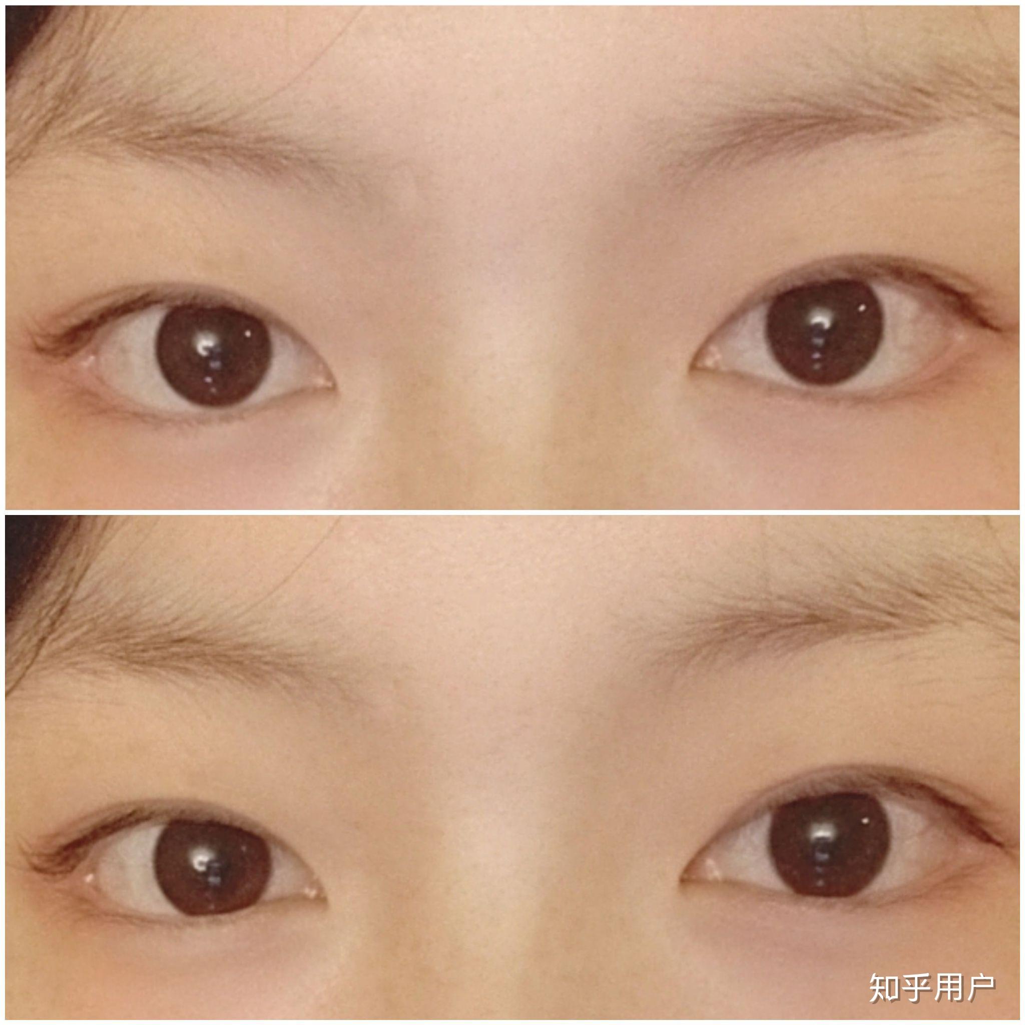 眼神无神和眼睛有神是怎么区别的