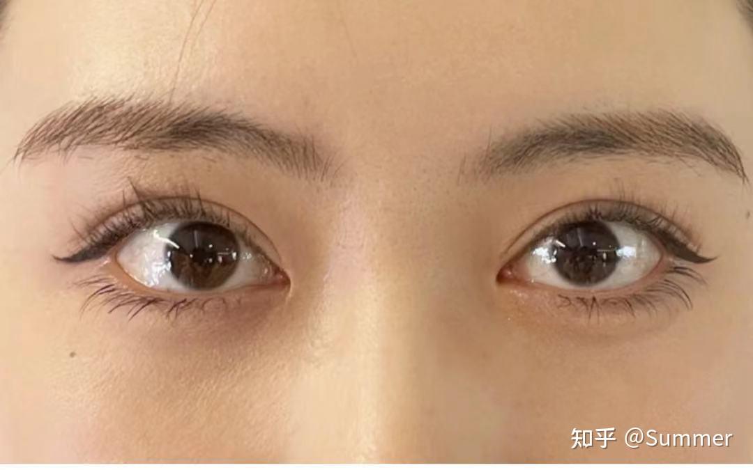 上海双眼皮哪家好