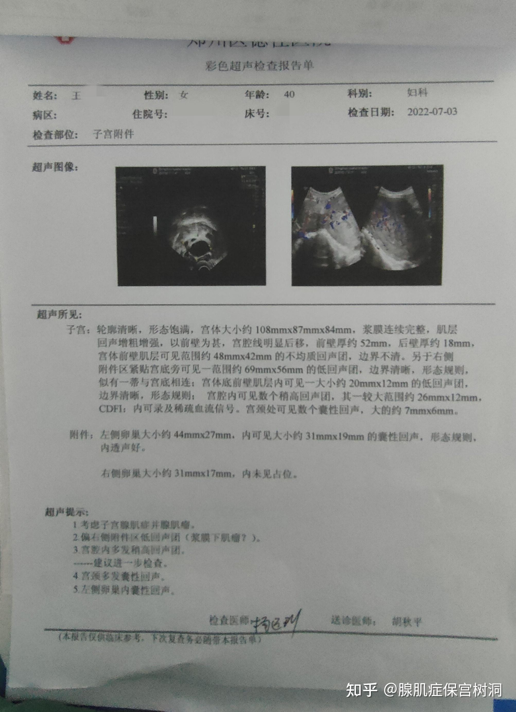 海南省乐东黎族自治县子宫腺肌症患者投稿