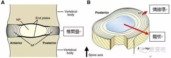 颈 腰椎间盘突出治疗手段 知乎