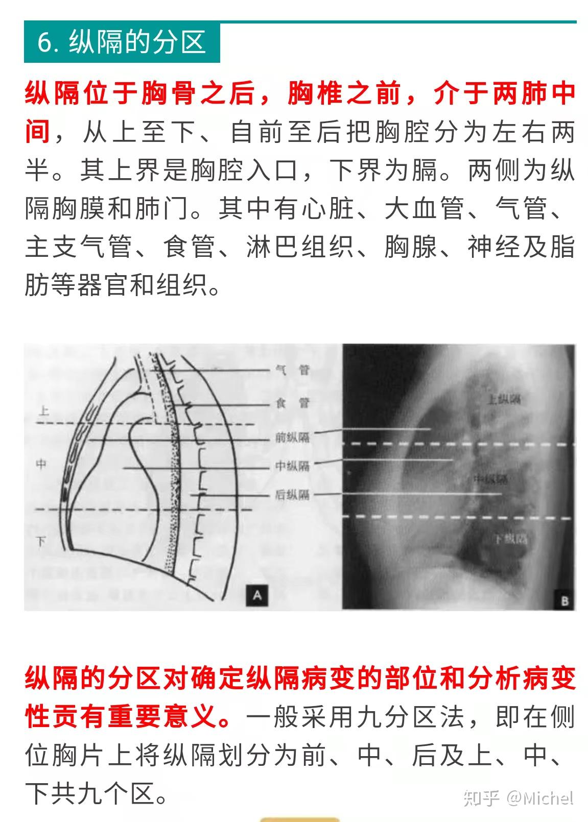 一分钟学会看胸片