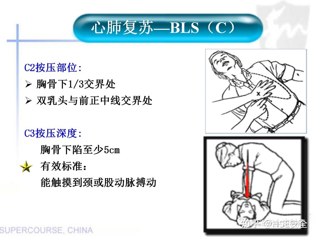 PPT |【课件】新版心肺复苏课件 - 知乎